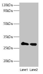 Western blot All lanes: TPMT antibody at 2µg/ml Lane 1: EC109 whole cell lysate Lane 2: 293T whole cell lysate Secondary Goat polyclonal to rabbit IgG at 1/15000 dilution Predicted band size: 29 kDa Observed band size: 29 kDa