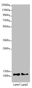 Western blot All lanes: COX7A2L antibody at 2.08µg/ml Lane 1: A549 whole cell lysate Lane 2: HepG2 whole cell lysate Secondary Goat polyclonal to rabbit IgG at 1/10000 dilution Predicted band size: 13 kDa Observed band size: 13 kDa