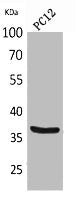 Western Blot analysis of PC12 cells using BST-1 Polyclonal Antibody.