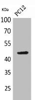 Western Blot analysis of PC-12 cells using NKp44 Polyclonal Antibody.