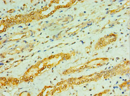 Immunohistochemistry of paraffin-embedded human kidney tissue using CSB-PA005875ESR2HU at dilution of 1:100