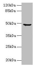Western blot All lanes: CPA2 antibody at 1.5µg/ml + Hela whole cell lysate Secondary Goat polyclonal to rabbit IgG at 1/10000 dilution Predicted band size: 48 kDa Observed band size: 48 kDa