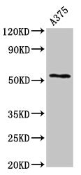 Western Blot Positive WB detected in: A375 whole cell lysate All lanes: CPE antibody at 2.7µg/ml Secondary Goat polyclonal to rabbit IgG at 1/50000 dilution Predicted band size: 54, 50 kDa Observed band size: 54 kDa