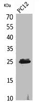 Western Blot analysis of PC12 cells using CMTM5 Polyclonal Antibody.