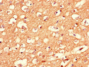 Immunohistochemistry of paraffin-embedded human brain tissue using CSB-PA005893LA01HU at dilution of 1:100