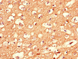 Immunohistochemistry of paraffin-embedded human brain tissue using CSB-PA005893LA01HU at dilution of 1:100