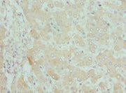 Immunohistochemistry of paraffin-embedded human liver tissue using CSB-PA005898ESR1HU at dilution of 1:100
