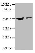 Western blot All lanes: CPN1 antibody at 6.19µg/ml Lane 1: Mouse liver tissue Lane 2: MCF-7 whole cell lysate Secondary Goat polyclonal to rabbit IgG at 1/10000 dilution Predicted band size: 52 kDa Observed band size: 52 kDa