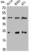 Western Blot analysis of HeLa, K562, 4T1 cells using TMEM173 Polyclonal Antibody.