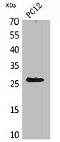 Western Blot analysis of PC12 cells using POLR3G Polyclonal Antibody.