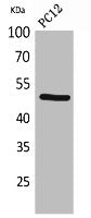 Western Blot analysis of PC12 cells using CRF-RI Polyclonal Antibody.