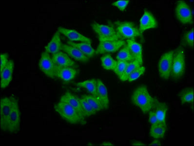 Immunofluorescence staining of HepG2 cells with CSB-PA005909LA01HU at 1:100, counter-stained with DAPI. The cells were fixed in 4% formaldehyde, permeabilized using 0.2% Triton X-100 and blocked in 10% normal Goat Serum. The cells were then incuba...