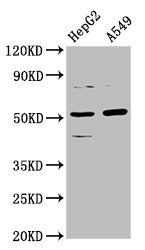 Western Blot Positive WB detected in: HepG2 whole cell lysate, A549 whole cell lysate All lanes: CPOX antibody at 5.7µg/ml Secondary Goat polyclonal to rabbit IgG at 1/50000 dilution Predicted band size: 51, 31 kDa Observed band size: 51 kDa