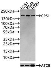 Western Blot Positive WB detected in: U251 whole cell lysate(30µg), K562 whole cell lysate(30µg), HT29 whole cell lysate(30µg) All lanes: CPS1 antibody at 1:1000 Secondary Goat polyclonal to rabbit IgG at 1/20000 dilution Predicted band size: 165,...
