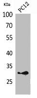 Western Blot analysis of PC12 cells using HLA-DQB1/2 Polyclonal Antibody.