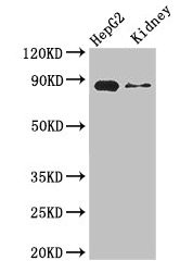 Western Blot Positive WB detected in: HepG2 whole cell lysate, Mouse kidney tissue All lanes: CPT1A antibody at 3.4ug/ml Secondary Goat polyclonal to rabbit IgG at 1/50000 dilution Predicted band size: 89, 87 kDa Observed band size: 89 kDa