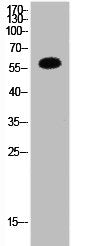 Western Blot analysis of HepG2 cells using HDAC1 Polyclonal Antibody