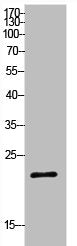 Western Blot analysis of HeLa cells using SRY Polyclonal Antibody