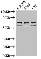 Western Blot Positive WB detected in: HEK293 whole cell lysate, A549 whole cell lysate, U87 whole cell lysate All lanes: CPZ antibody at 3µg/ml Secondary Goat polyclonal to rabbit IgG at 1/50000 dilution Predicted band size: 74 kDa Observed band s...