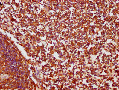 IHC image of CSB-PA005934LA01HU diluted at 1:200 and staining in paraffin-embedded human lymph node tissue performed on a Leica BondTM system. After dewaxing and hydration, antigen retrieval was mediated by high pressure in a citrate buffer (pH 6....