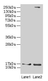 Western blot All lanes: CRABP1 antibody at 4µg/ml Lane 1: Mouse eye tissue Lane 2: THP-1 whole cell lysate Secondary Goat polyclonal to rabbit IgG at 1/10000 dilution Predicted band size: 16 kDa Observed band size: 16 kDa