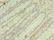 Immunohistochemistry of paraffin-embedded human colon tissue using CSB-PA005938ESR1HU at dilution of 1:100