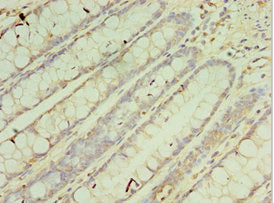 Immunohistochemistry of paraffin-embedded human colon tissue using CSB-PA005938ESR1HU at dilution of 1:100