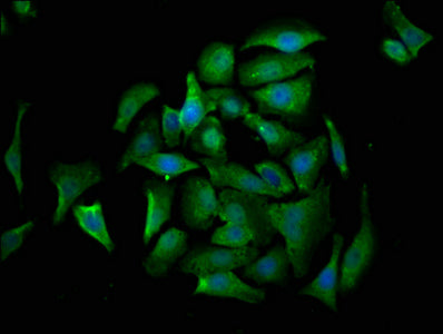 Immunofluorescence staining of A549 cells with CSB-PA005938HA01HU at 1:530, counter-stained with DAPI. The cells were fixed in 4% formaldehyde, permeabilized using 0.2% Triton X-100 and blocked in 10% normal Goat Serum. The cells were then incubat...