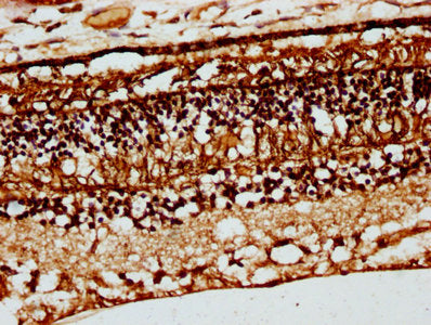 IHC image of CSB-PA005941DSR1HU diluted at 1:66 and staining in paraffin-embedded human eye tissue performed on a Leica BondTM system. After dewaxing and hydration, antigen retrieval was mediated by high pressure in a citrate buffer (pH 6.0). Sect...