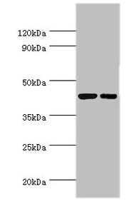 Western blot All lanes: Cyclic AMP-responsive element-binding protein 3 antibody at 6ug/ml Lane 1: Jurkat whole cell lysate Lane 2: HepG2 whole cell lysate Secondary Goat polyclonal to rabbit IgG at 1/10000 dilution Predicted band size: 44, 42, 40...