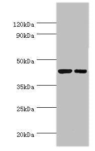 Western blot All lanes: Cyclic AMP-responsive element-binding protein 3 antibody at 6ug/ml Lane 1: Jurkat whole cell lysate Lane 2: HepG2 whole cell lysate Secondary Goat polyclonal to rabbit IgG at 1/10000 dilution Predicted band size: 44, 42, 40...
