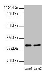 Western blot All lanes: RPL8 antibody at 2µg/ml Lane 1: EC109 whole cell lysate Lane 2: 293T whole cell lysate Secondary Goat polyclonal to rabbit IgG at 1/10000 dilution Predicted band size: 29 kDa Observed band size: 29 kDa