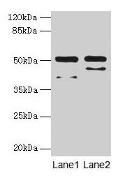 Western blot All lanes: CRHR1 antibody at 16µg/ml Lane 1: Hela whole cell lysate Lane 2: HL60 whole cell lysate Secondary Goat polyclonal to rabbit IgG at 1/10000 dilution Predicted band size: 51, 48, 44, 47, 29 kDa Observed band size: 51 kDa