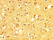 IHC image of CSB-PA005965YA01HU diluted at 1:500 and staining in paraffin-embedded human brain tissue performed on a Leica BondTM system. After dewaxing and hydration, antigen retrieval was mediated by high pressure in a citrate buffer (pH 6.0). S...