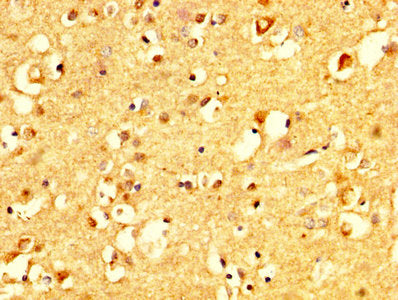 IHC image of CSB-PA005965YA01HU diluted at 1:500 and staining in paraffin-embedded human brain tissue performed on a Leica BondTM system. After dewaxing and hydration, antigen retrieval was mediated by high pressure in a citrate buffer (pH 6.0). S...