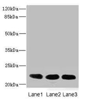 Western blot All lanes: CRIP2 antibody at 4.68µg/ml Lane 1: Rat heart tissue Lane 2: Mouse lung tissue Lane 3: MCF-7 whole cell lysate Secondary Goat polyclonal to rabbit IgG at 1/10000 dilution Predicted band size: 23, 31 kDa Observed band size:...