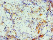 Immunohistochemistry of paraffin-embedded human testis tissue using CSB-PA005975ESR2HU at dilution of 1:100