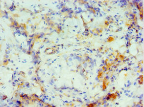 Immunohistochemistry of paraffin-embedded human testis tissue using CSB-PA005975ESR2HU at dilution of 1:100