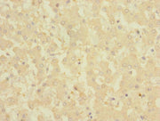 Immunohistochemistry of paraffin-embedded human liver tissue using CSB-PA005983ESR1HU at dilution of 1:100