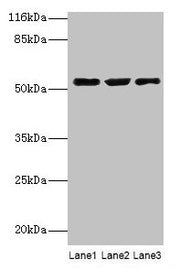 Western blot All lanes: CRNN antibody at 12µg/ml Lane 1: HepG2 whole cell lysate Lane 2: Mouse heart tissue Lane 3: Rat skeletal muscle tissue Secondary Goat polyclonal to rabbit IgG at 1/10000 dilution Predicted band size: 54 kDa Observed band si...