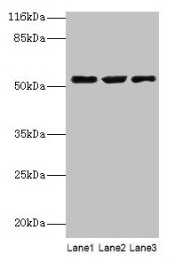 Western blot All lanes: CRNN antibody at 12µg/ml Lane 1: HepG2 whole cell lysate Lane 2: Mouse heart tissue Lane 3: Rat skeletal muscle tissue Secondary Goat polyclonal to rabbit IgG at 1/10000 dilution Predicted band size: 54 kDa Observed band si...