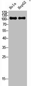 Western Blot analysis of HeLa HepG2 cells using SREBP-1 Polyclonal Antibody