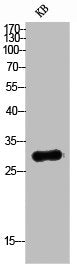 Western Blot analysis of KB cells using TRAIL Polyclonal Antibody