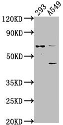 Western Blot Positive WB detected in: 293 whole cell lysate, A549 whole cell lysate All lanes: CRTAC1 antibody at 1:1000 Secondary Goat polyclonal to rabbit IgG at 1/50000 dilution Predicted band size: 72, 71, 69 kDa Observed band size: 72 kDa