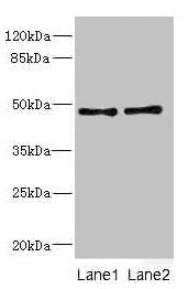 Western blot All lanes: CRTAP antibody at 0.96µg/ml Lane 1: 293T whole cell lysate Lane 2: Hela whole cell lysate Secondary Goat polyclonal to rabbit IgG at 1/10000 dilution Predicted band size: 47 kDa Observed band size: 47 kDa