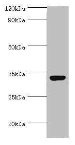 Western blot All lanes: CRX antibody at 2ug/ml + 293T whole cell lysate Secondary Goat polyclonal to rabbit IgG at 1/10000 dilution Predicted band size: 32 kDa Observed band size: 32 kDa