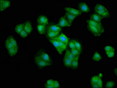 Immunofluorescence staining of HepG2 cells with CSB-PA006007LA01HU at 1:66, counter-stained with DAPI. The cells were fixed in 4% formaldehyde, permeabilized using 0.2% Triton X-100 and blocked in 10% normal Goat Serum. The cells were then incubat...
