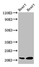 Western Blot Positive WB detected in: Rat heart tissue, Mouse heart tissue All lanes: CRYAB antibody at 2µg/ml Secondary Goat polyclonal to rabbit IgG at 1/50000 dilution Predicted band size: 21 kDa Observed band size: 21 kDa