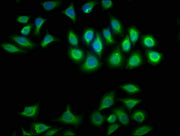Immunofluorescence staining of A549 cells with CSB-PA006009LA01HU at 1:100, counter-stained with DAPI. The cells were fixed in 4% formaldehyde, permeabilized using 0.2% Triton X-100 and blocked in 10% normal Goat Serum. The cells were then incubat...