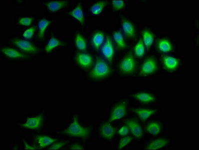 Immunofluorescence staining of A549 cells with CSB-PA006009LA01HU at 1:100, counter-stained with DAPI. The cells were fixed in 4% formaldehyde, permeabilized using 0.2% Triton X-100 and blocked in 10% normal Goat Serum. The cells were then incubat...